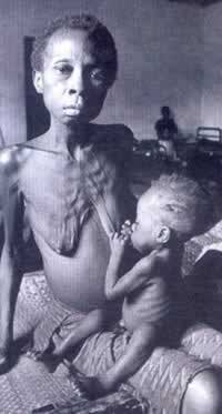 尼日利亚内战导致饥荒灾难